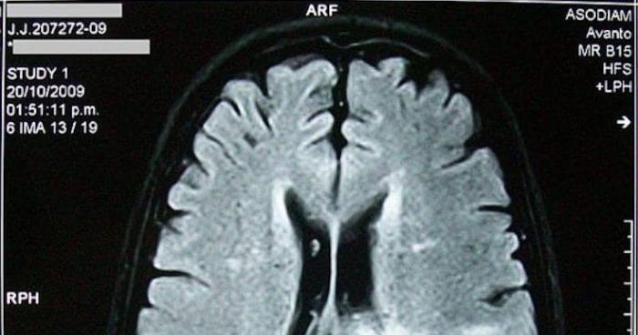 Forskere: Å være glemsk er et tegn på at du er uvanlig intelligent!